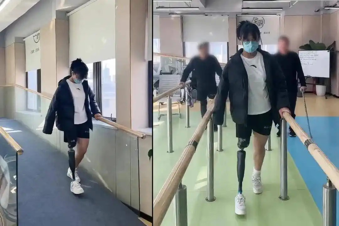 游泳冠军残疾_游泳冠军第一人_假肢游泳世界冠军